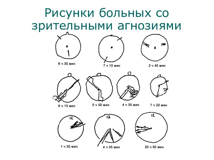 Рисунки больных со зрительными агнозиями