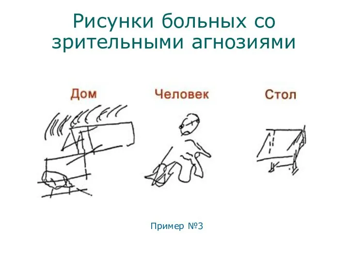 Рисунки больных со зрительными агнозиями Пример №3