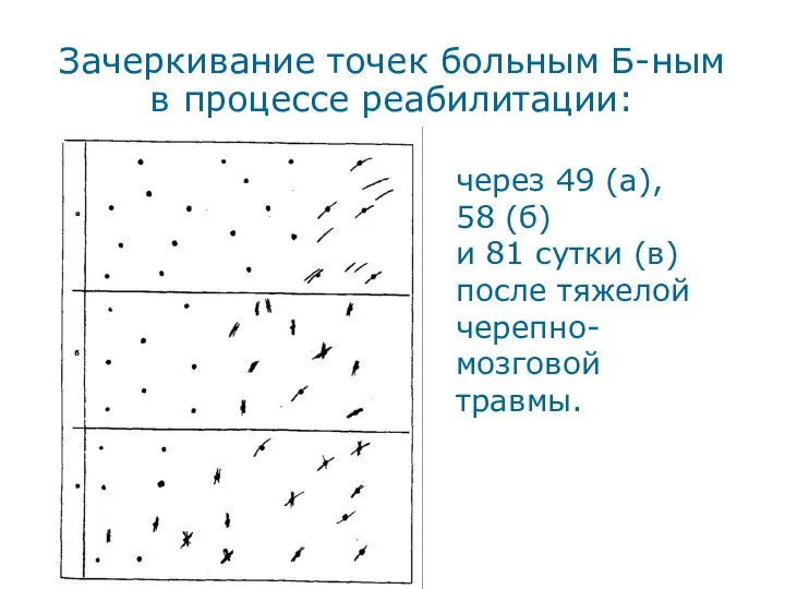 Зачеркивание точек больным Б-ным в процессе реабилитации: через 49 (а), 58