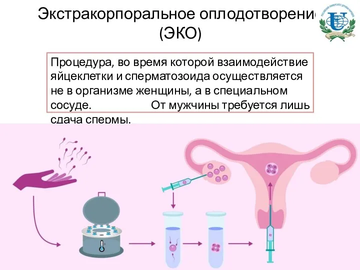 Экстракорпоральное оплодотворение (ЭКО) Процедура, во время которой взаимодействие яйцеклетки и сперматозоида