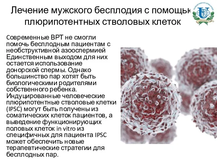 Лечение мужского бесплодия с помощью плюрипотентных стволовых клеток Cовременные ВРТ не
