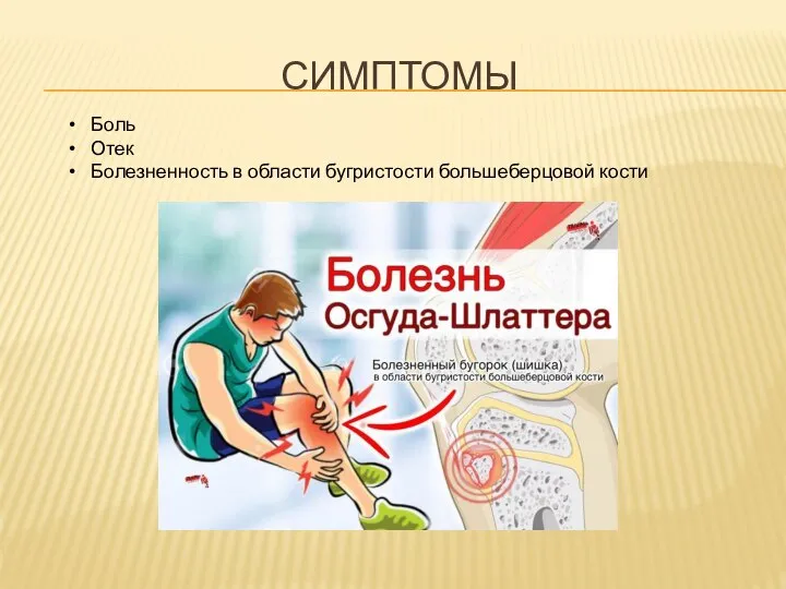 СИМПТОМЫ Боль Отек Болезненность в области бугристости большеберцовой кости