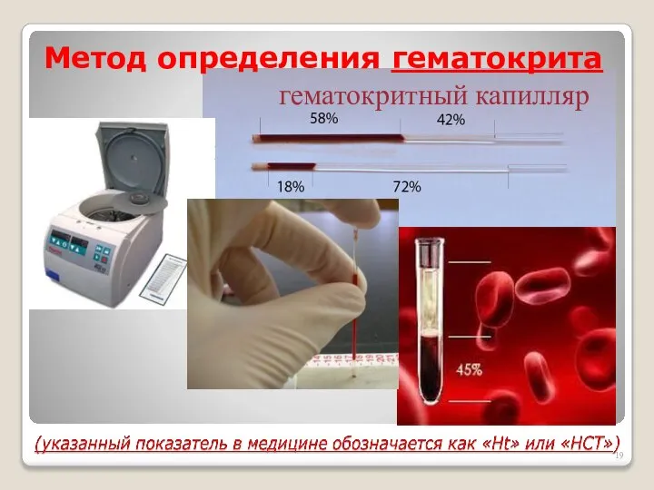 Метод определения гематокрита гематокритный капилляр