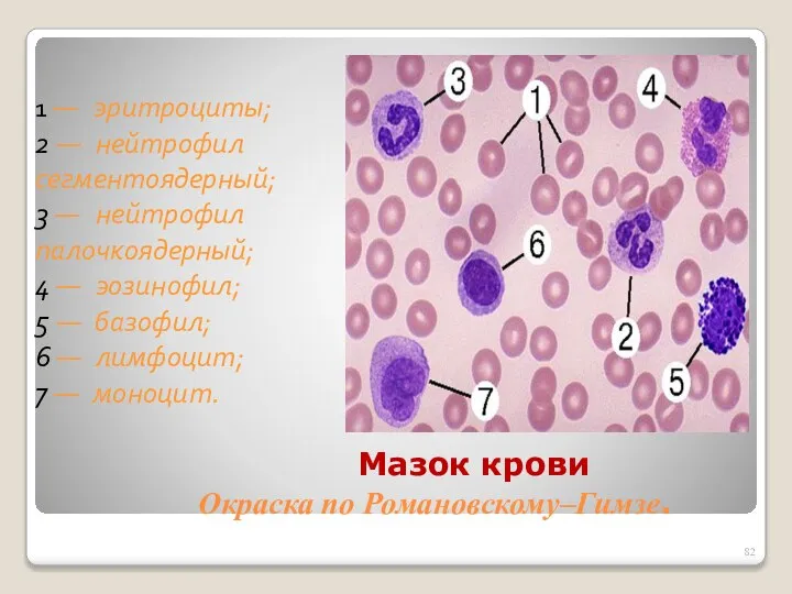 Мазок крови Окраска по Романовскому–Гимзе. 1 — эритроциты; 2 — нейтрофил