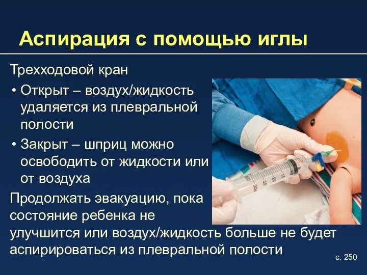 Аспирация с помощью иглы Трехходовой кран Открыт – воздух/жидкость удаляется из