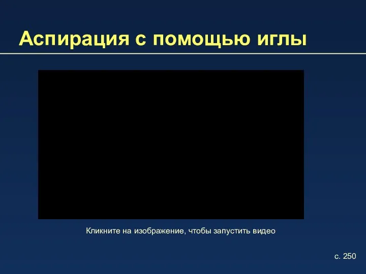 Аспирация с помощью иглы Кликните на изображение, чтобы запустить видео с. 250