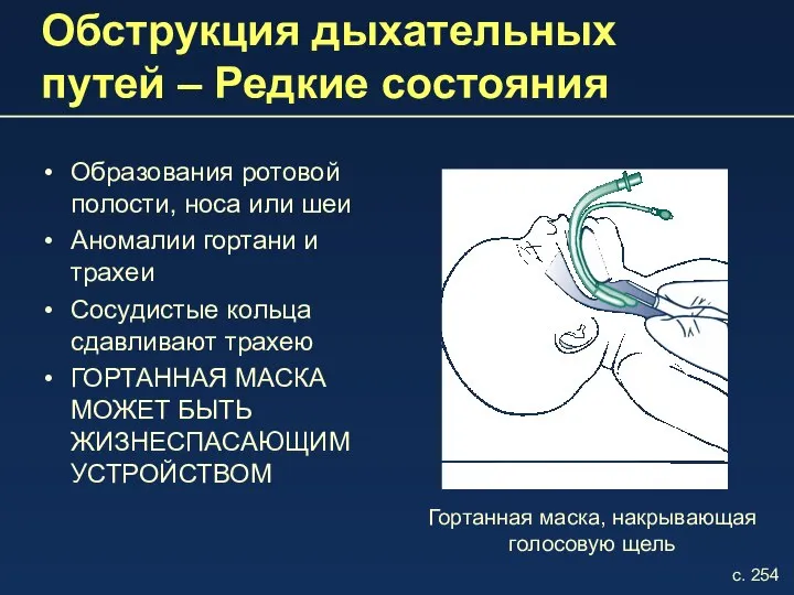 Обструкция дыхательных путей – Редкие состояния Образования ротовой полости, носа или