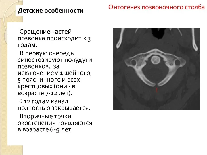 Сращение частей позвонка происходит к 3 годам. В первую очередь синостозируют