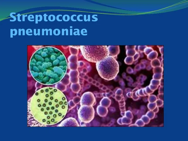 Streptococcus pneumoniae