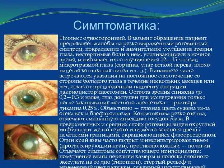 Симптоматика: Процесс односторонний. В момент обращения пациент предъявляет жалобы на резко