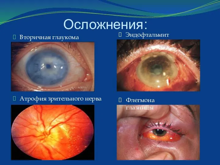 Осложнения: Вторичная глаукома Атрофия зрительного нерва Эндофтальмит Флегмона глазницы