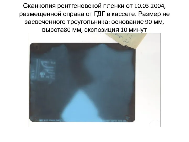 Сканкопия рентгеновской пленки от 10.03.2004, размещенной справа от ГДГ в кассете.