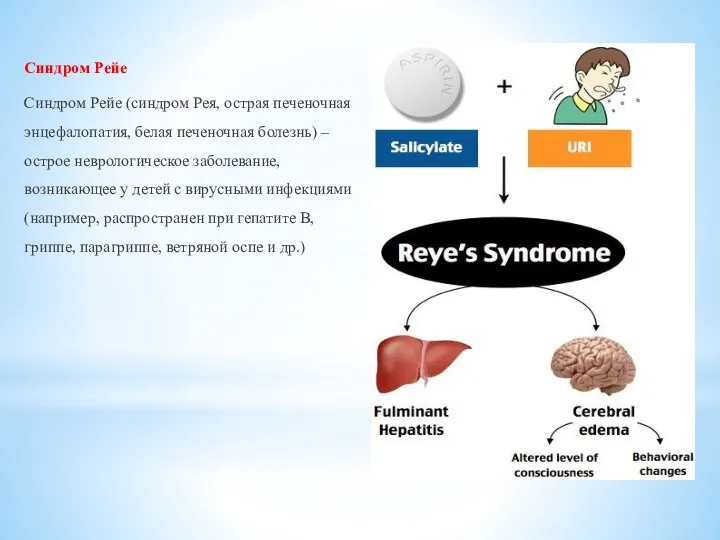 Синдром Рейе Синдром Рейе (синдром Рея, острая печеночная энцефалопатия, белая печеночная