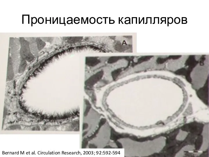 Проницаемость капилляров Bernard M et al. Circulation Research, 2003; 92:592-594