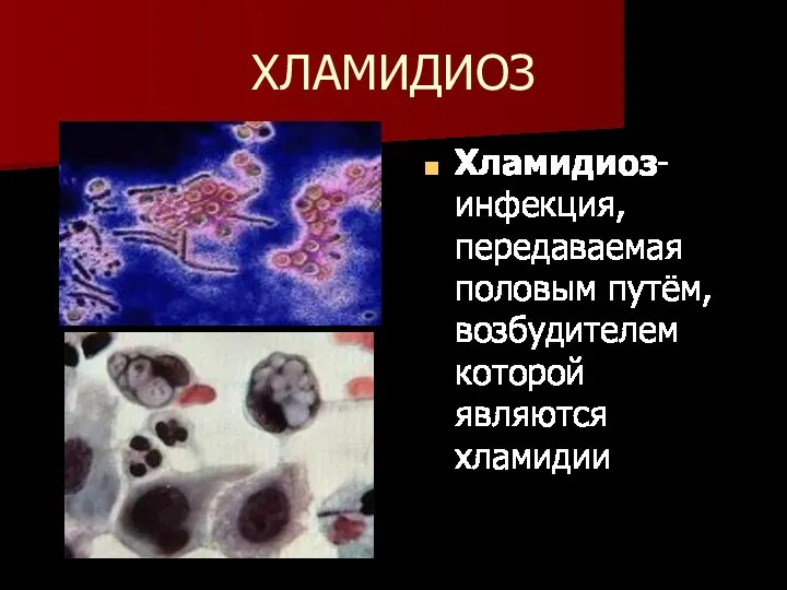 ХЛАМИДИОЗ Хламидиоз- инфекция, передаваемая половым путём, возбудителем которой являются хламидии