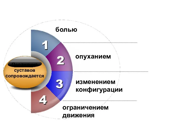 1 4 болью опуханием изменением конфигурации 2 3 ограничением движения Поражение суставов сопровождается