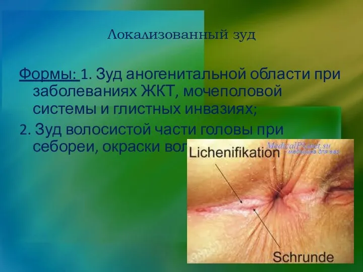 Локализованный зуд Формы: 1. Зуд аногенитальной области при заболеваниях ЖКТ, мочеполовой