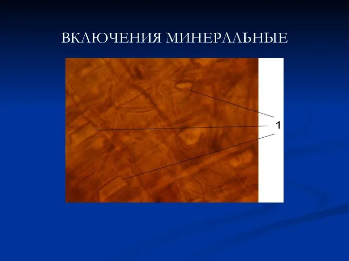 ВКЛЮЧЕНИЯ МИНЕРАЛЬНЫЕ