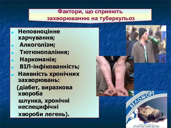 Фактори, що сприяють захворюванню на туберкульоз Неповноцінне харчування; Алкоголізм; Тютюнопаління; Наркоманія;