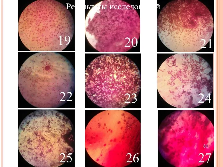 19 20 Результаты исследований 21 22 23 24 25 26 27