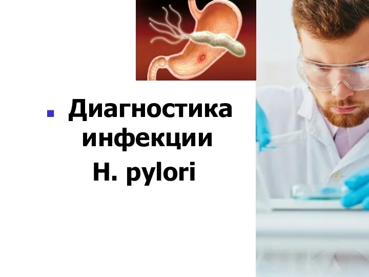 Диагностика инфекции H. pylori