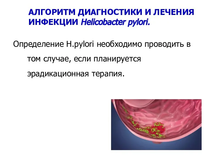 АЛГОРИТМ ДИАГНОСТИКИ И ЛЕЧЕНИЯ ИНФЕКЦИИ Helicobacter pylori. Определение Н.pylori необходимо проводить