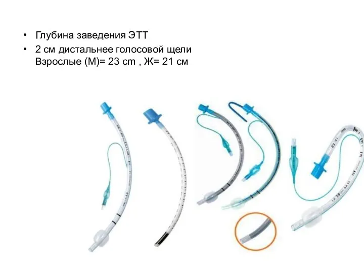 Глубина заведения ЭТТ 2 см дистальнее голосовой щели Взрослые (М)= 23 cm , Ж= 21 cм