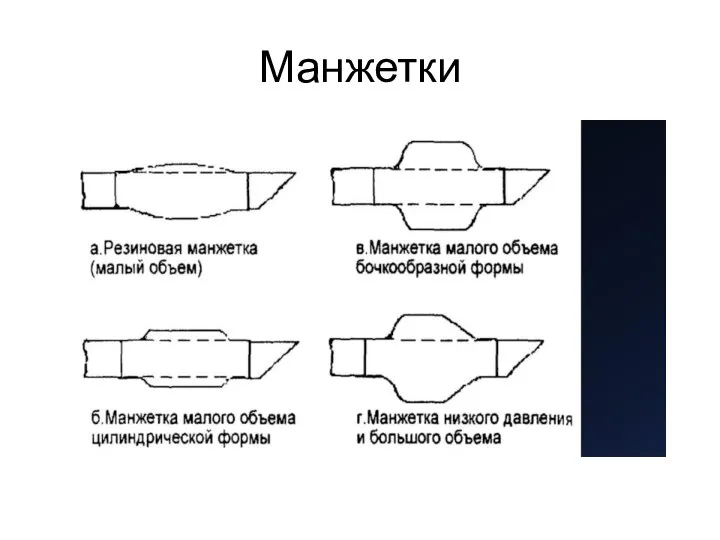 Манжетки