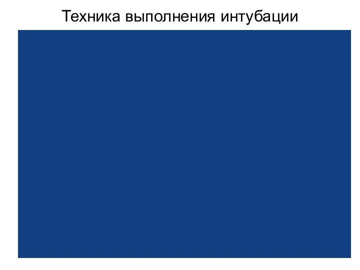 Техника выполнения интубации