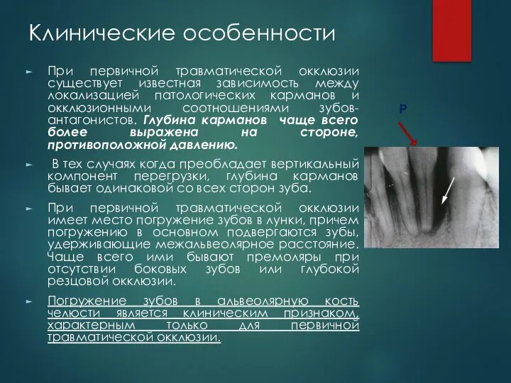 Клинические особенности При первичной травматической окклюзии существует известная зависимость между локализацией