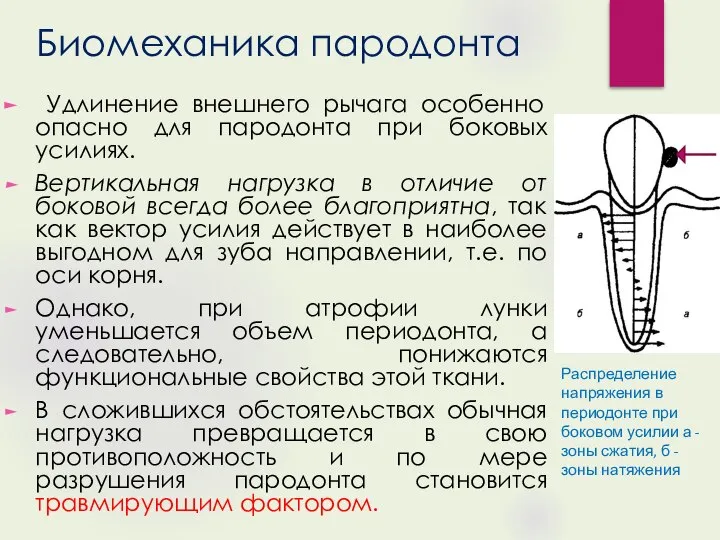 Биомеханика пародонта Удлинение внешнего рычага особенно опасно для пародонта при боковых