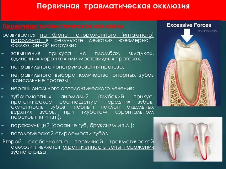 Первичная травматическая окклюзия Первичная травматическая окклюзия развивается на фоне непораженного (интактного)