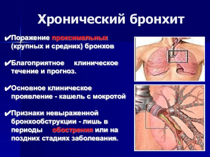 Хронический бронхит Поражение проксимальных (крупных и средних) бронхов Благоприятное клиническое течение