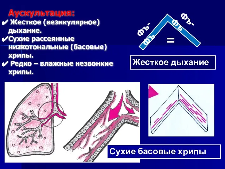 Фъ-Фъ Фъ-Фъ Жесткое дыхание = Сухие басовые хрипы Аускультация: Жесткое (везикулярное)