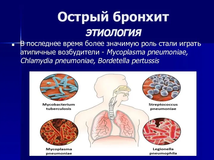 Острый бронхит этиология В последнее время более значимую роль стали играть