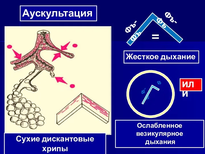 Фъ-Фъ Фъ-Фъ Жесткое дыхание = Ф-Ф Ф Ослабленное везикулярное дыхания Сухие дискантовые хрипы ИЛИ Аускультация