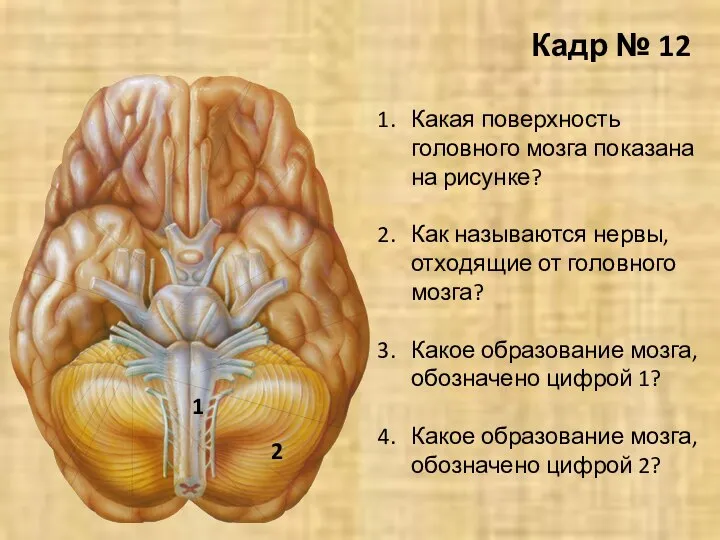 Кадр № 12 Какая поверхность головного мозга показана на рисунке? Как