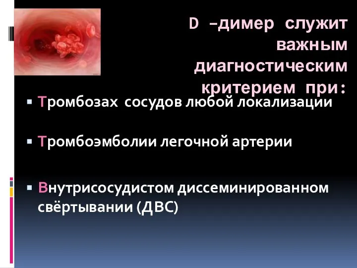 D –димер служит важным диагностическим критерием при: Тромбозах сосудов любой локализации