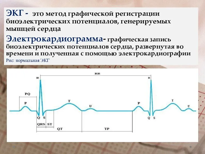 ЭКГ - это метод графической регистрации биоэлектрических потенциалов, генерируемых мышцей сердца