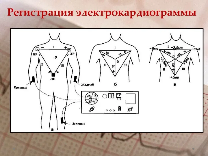 Регистрация электрокардиограммы