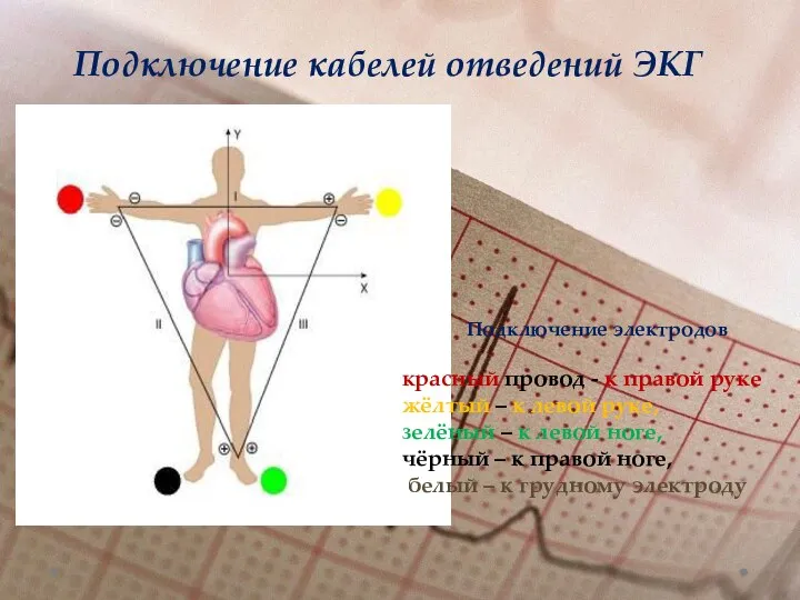 Подключение кабелей отведений ЭКГ Подключение электродов красный провод - к правой