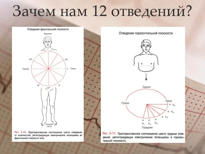 Зачем нам 12 отведений?