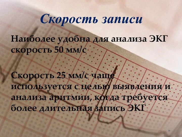 Скорость записи Наиболее удобна для анализа ЭКГ скорость 50 мм/с Скорость