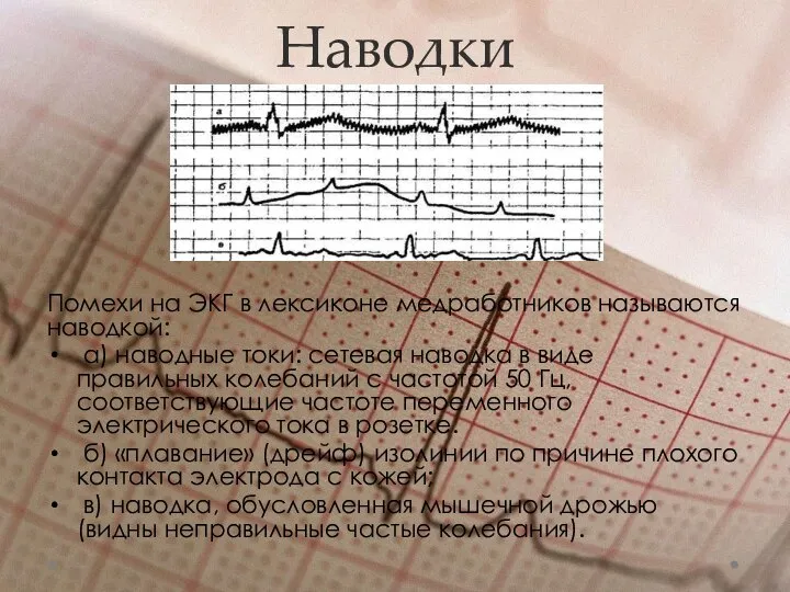 Наводки Помехи на ЭКГ в лексиконе медработников называются наводкой: а) наводные