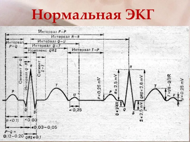 Нормальная ЭКГ