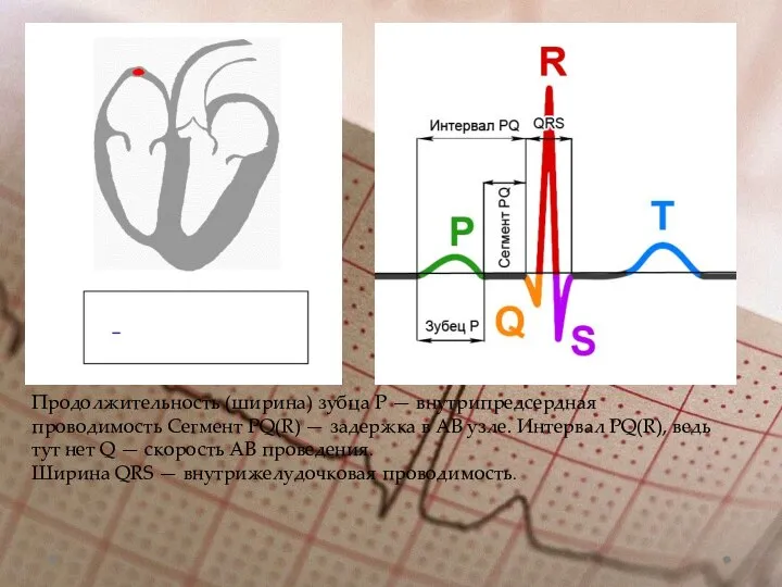 Продолжительность (ширина) зубца Р — внутрипредсердная проводимость Сегмент PQ(R) — задержка