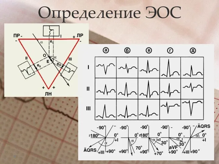 Определение ЭОС