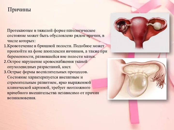 Причины Протекающее в тяжелой форме патологическое состояние может быть обусловлено рядом