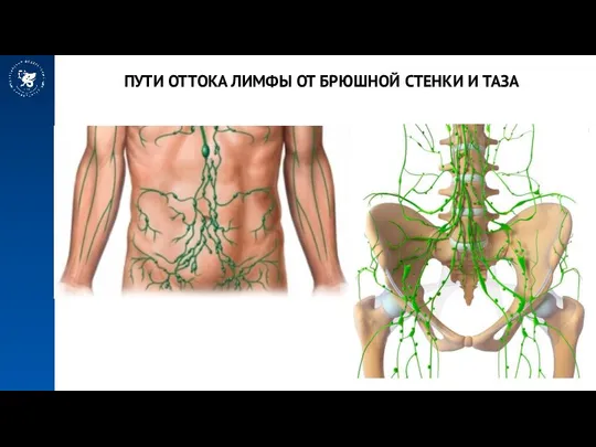 ПУТИ ОТТОКА ЛИМФЫ ОТ БРЮШНОЙ СТЕНКИ И ТАЗА