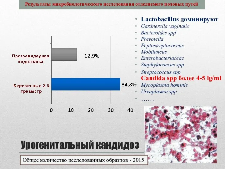 Урогенитальный кандидоз Lactobacillus доминируют Gardnerella vaginalis Bacteroides spp Prevotella Peptostreptococcus Mobiluncus